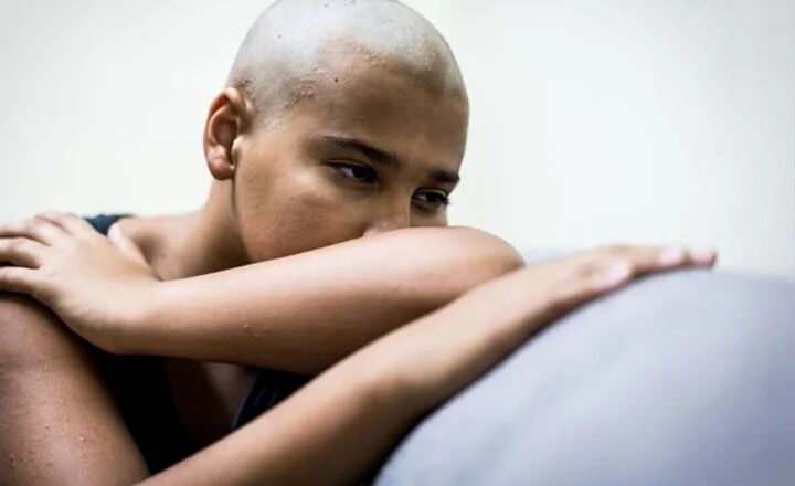 bald patient due to chemotherapy