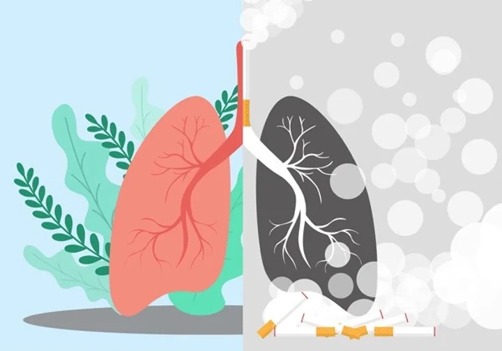 Lung Cancer The Deadliest